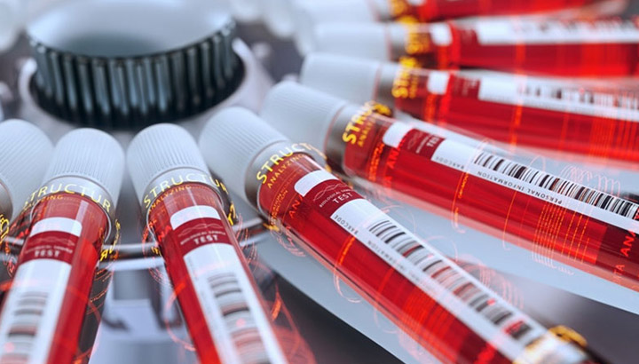 Applicazione della centrifugazione nell'industria farmaceutica